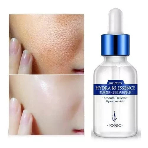 ACIDO HIALURÓNICO - DRO