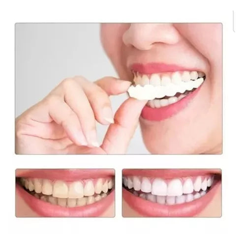 2pcs Carillas Dientes Postizos De Sonrisa Superior Inferior - BGP
