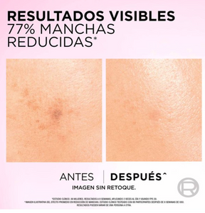 Rutina Anti-Manchas L'Oréal Glycolic Bright Gel 150 ml + Serum 30 ml + Crema 50 ml - ZK