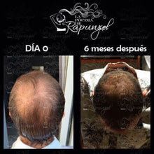 Cargar imagen en el visor de la galería, KIT SHAMPOO ANTI CAIDA CABALLERO - BGP