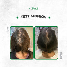 Cargar imagen en el visor de la galería, KIT SHAMPOO ANTI CAIDA DAMA - BGP