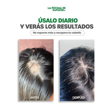 Cargar imagen en el visor de la galería, KIT SHAMPOO ANTI CAIDA DAMA - BGP